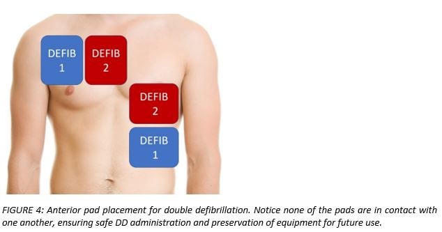 defibrillation