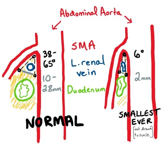 Abramo drawing 3.jpg