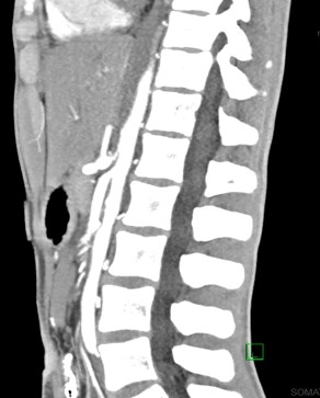 Abramo sma imaging 2.jpg