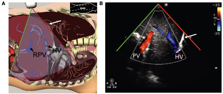 Venous Img 1.jpg