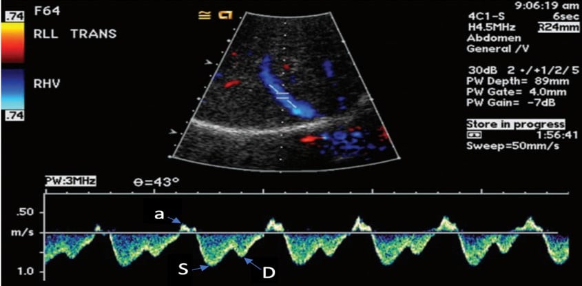 Venous Img 2.jpg