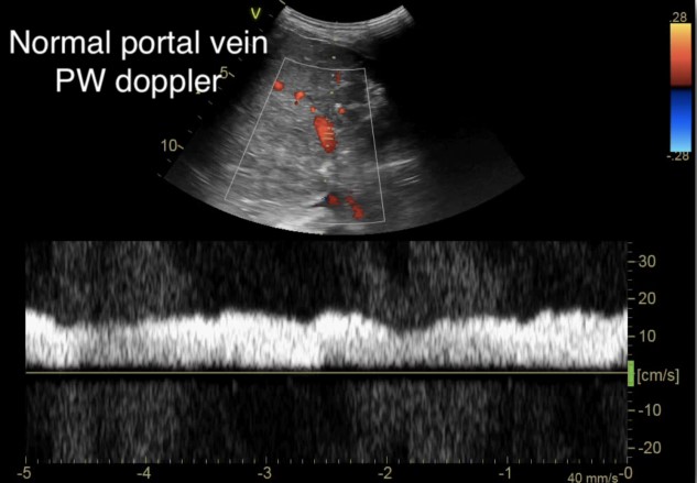 Venous Img 3.jpg