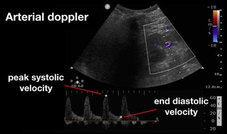 Venous Img 4.jpg