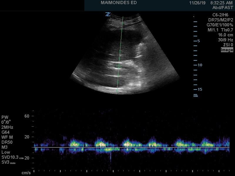 Venous Img 7.jpg