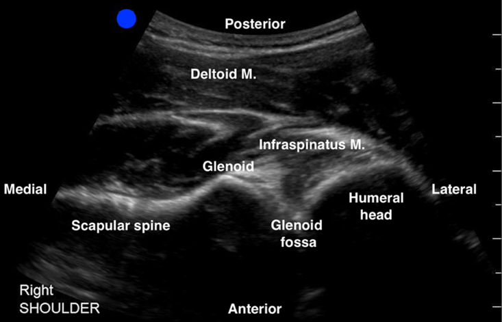 POCUS Image 1.png