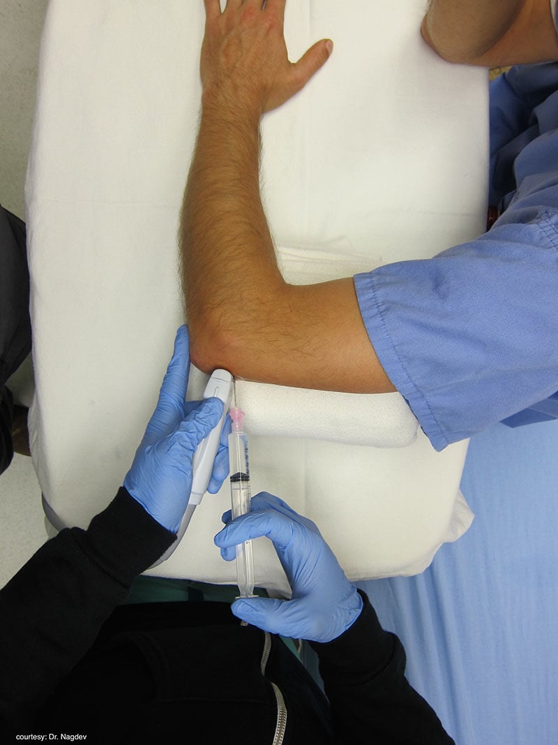 Sonoguide // Arthrocentesis