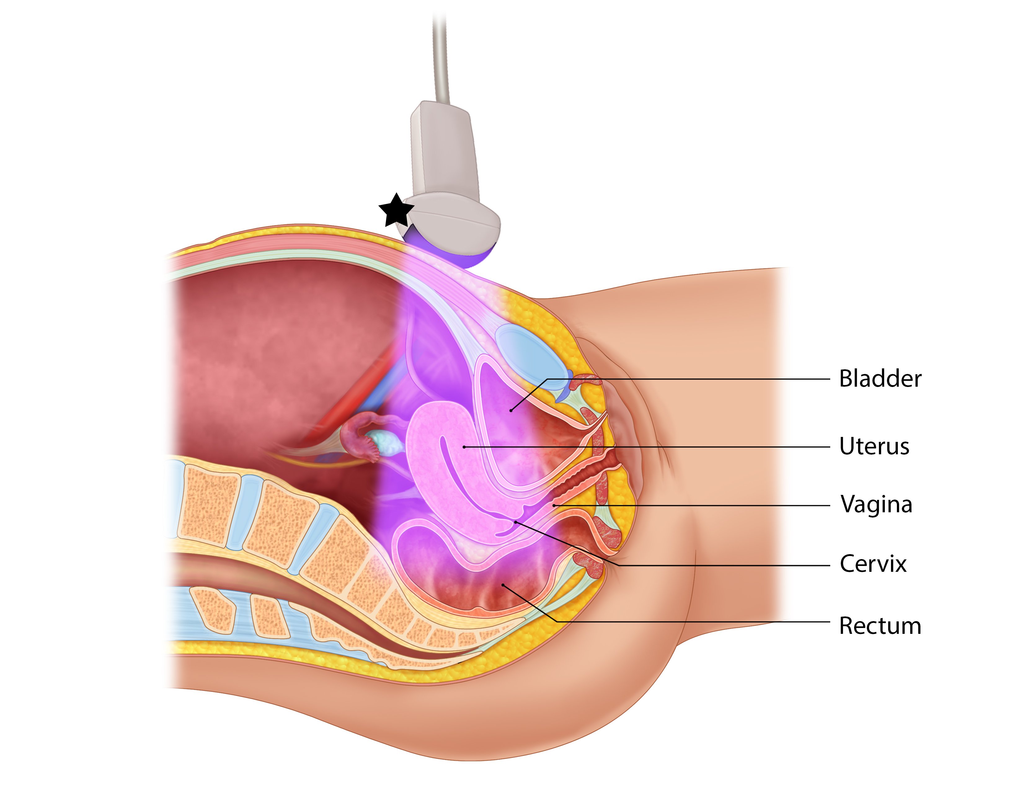 Illustration 3- Illustration of transverse approach and relevant anatomy. Probe indicator toward patient’s right (star).jpg