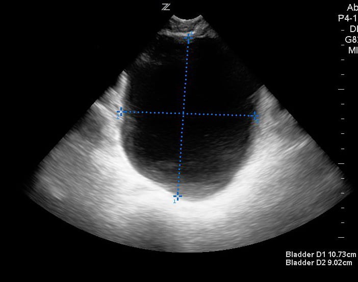 Sonoguide // Renal Ultrasound
