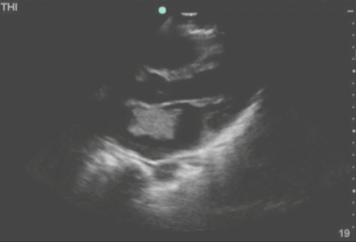 college acep seemingly pain foot student healthy case report