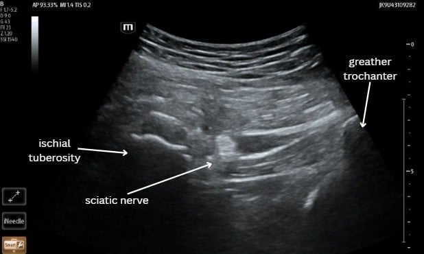 NovelTransFigure 1.jpg