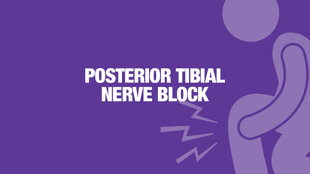 Lower Extremity Nerve Blocks Poster (in)