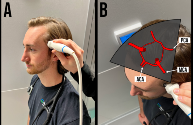 Transcranial Figure1.png