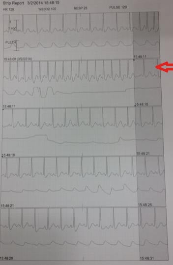 chest-pain-2.jpg