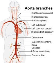 Abdominal Aorta Diagram 3000x2225 Abdominal Aorta Diagram 3000x2225