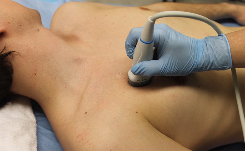 Figure 16 - Probe position for anterior thoracic view.jpg