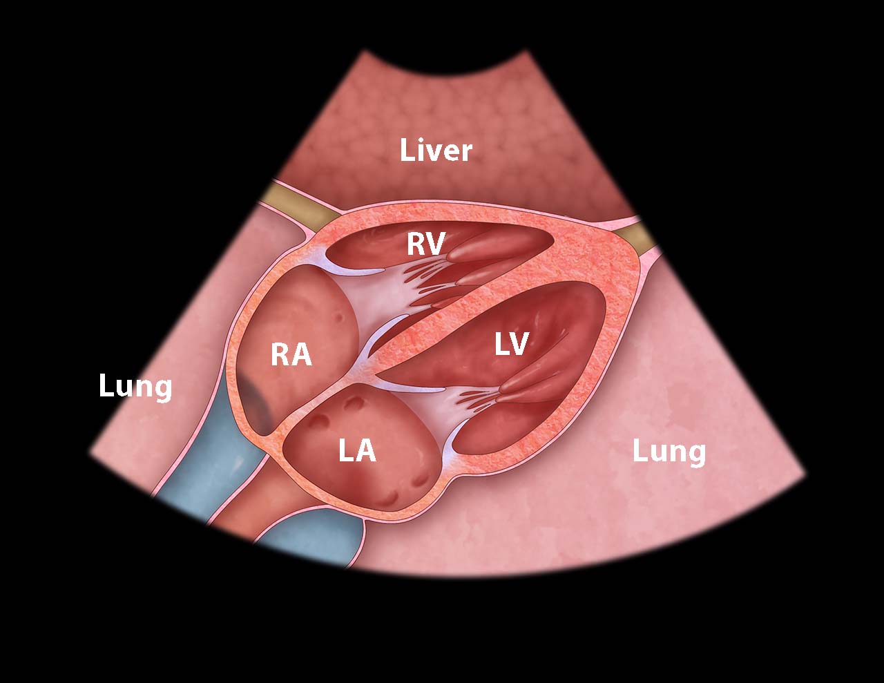Ill 2_Cardiac anatomy from subxiphoid view.jpg