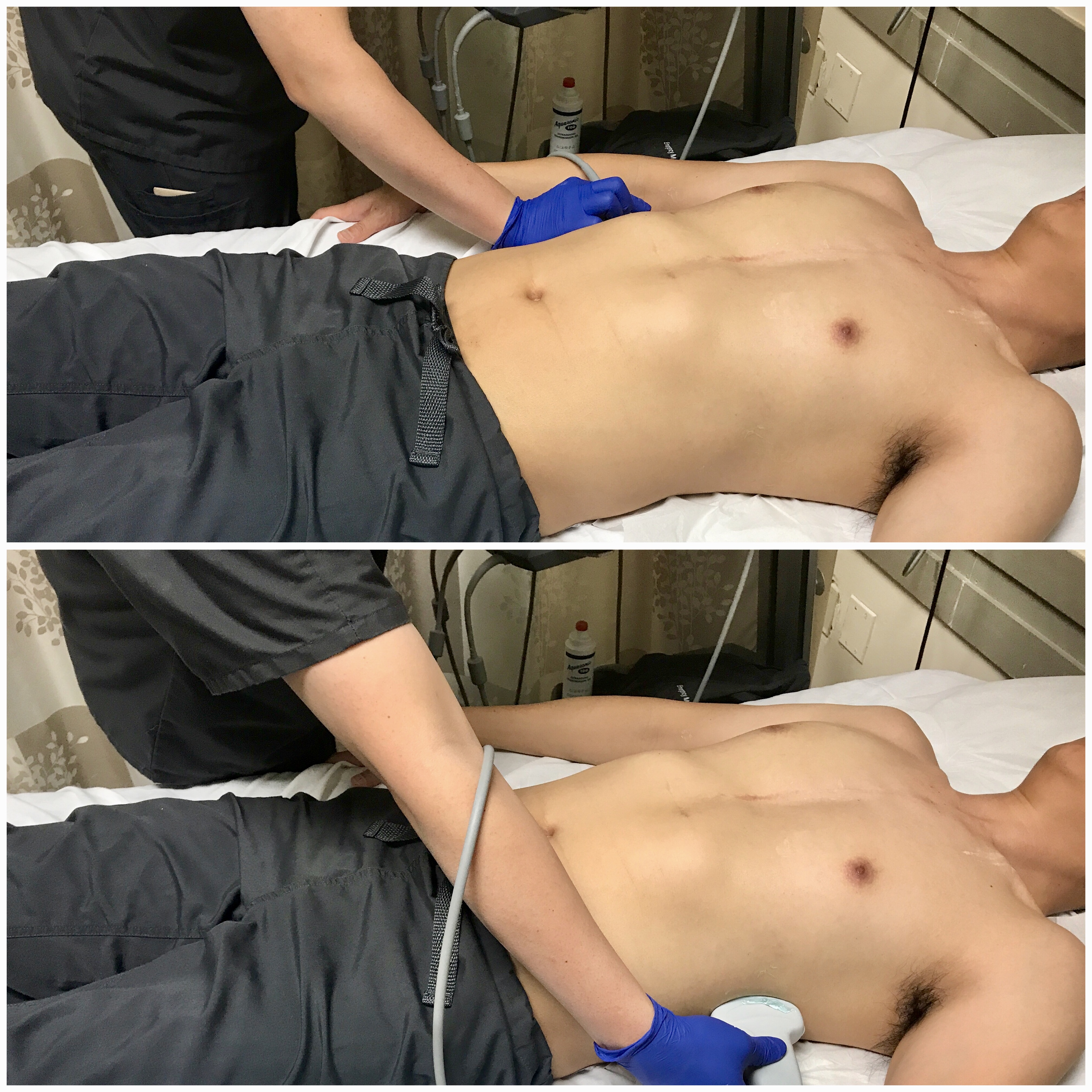 Image 14 - Transducer placement and orientation for evaluating for pleural effusion in the supine patient.jpg