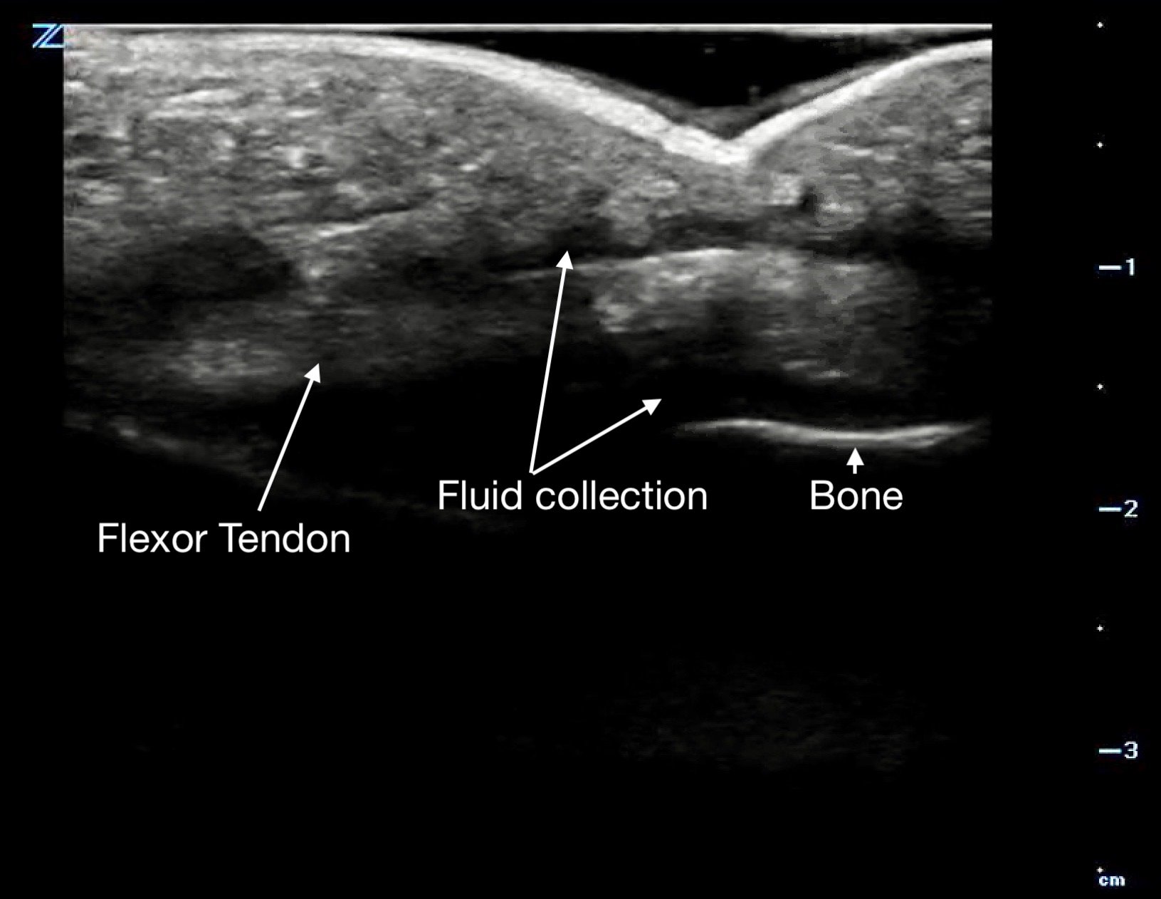 MSK-Figure 14b - FTS long.jpeg