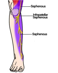 Saphenous Nerve Block Sonoguide