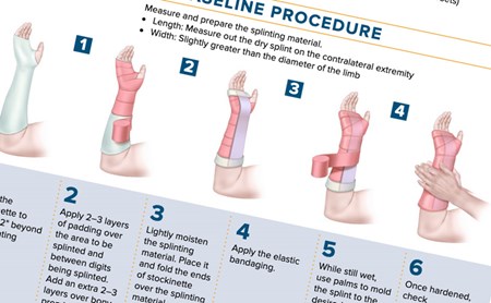 Emra Splint Guide.pdf EMRA Splinting Guide | Sports Medicine Section