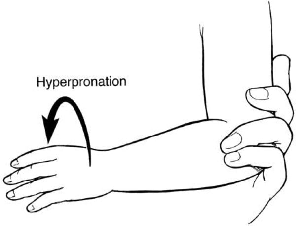 Fig 16..nursemaid hyperpronation.jpg