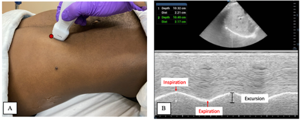 BeyondBreathFig 1AB.png