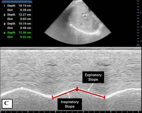 BeyondBreathFig 1C.jpg
