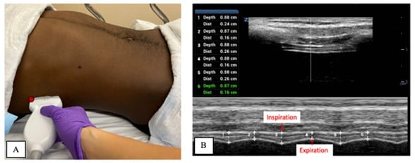 BeyondBreathFig 2AB.jpg