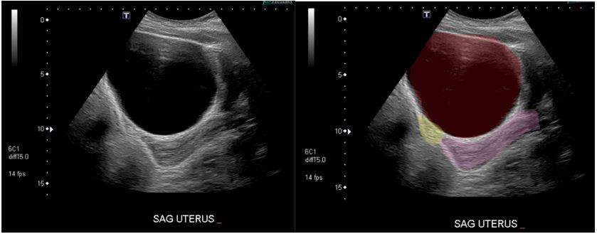 Transab Ultrasound.JPG