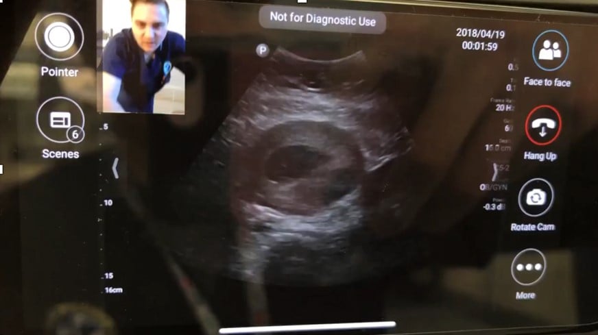 portable-ultrasound-1.jpg