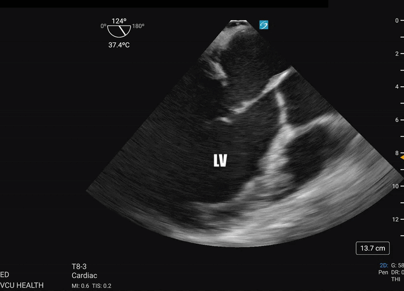 Stay'nAlive ME-LAX figure 1.gif