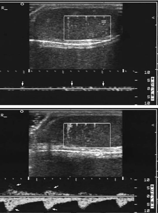 testivenouswaveform.jpg