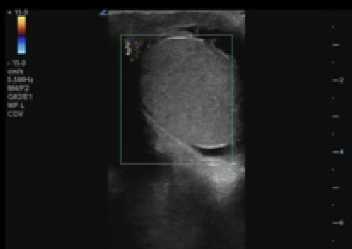 Torsion - Image 1_crop.png