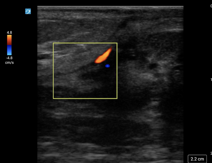 Torsion - image 4_crop.png