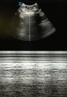 Transforming Img 1.gif