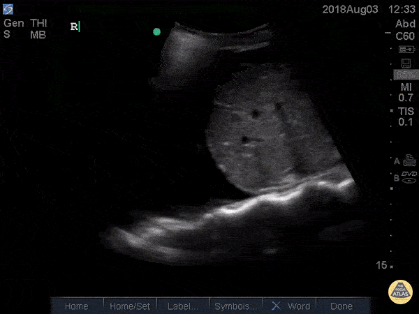 Transforming SpineSign.gif