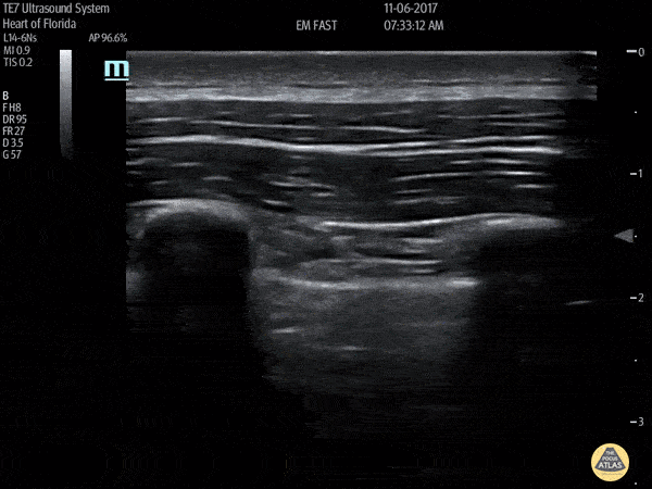 Transforming Vid 3.gif
