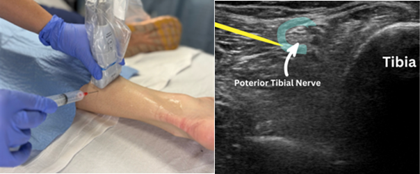 Use of POCUS_Figure 2 r-l.png
